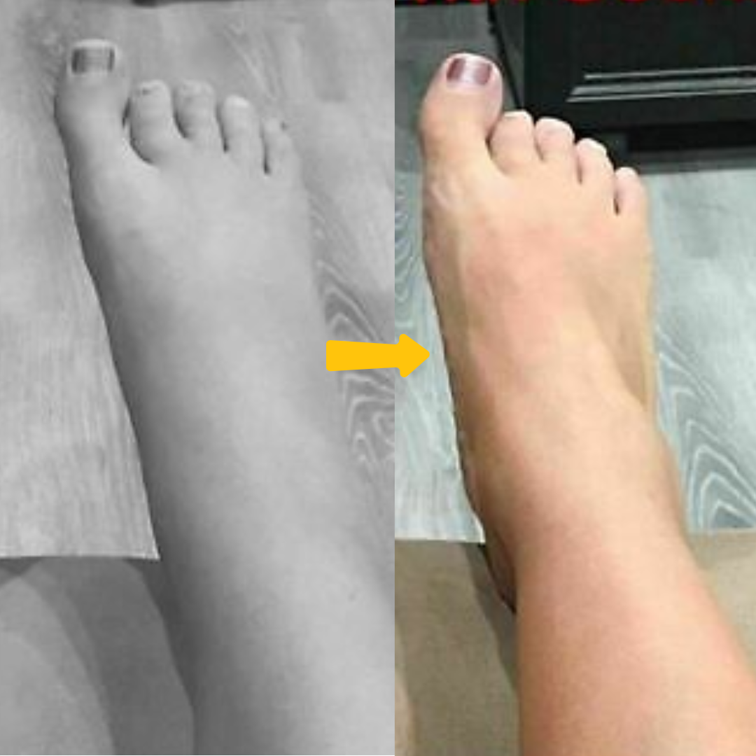 Ultra Fit-Socks - Boost Circulation Reduce Swelling & Walk Pain-Free